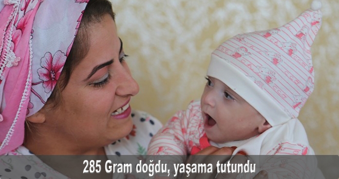 285 Gram doğdu, yaşama tutundu